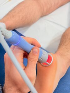 laserterapia roma prati